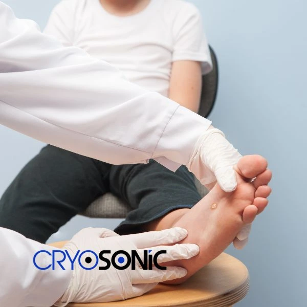 Are you looking for fast effective wart removal Contact us today Derby