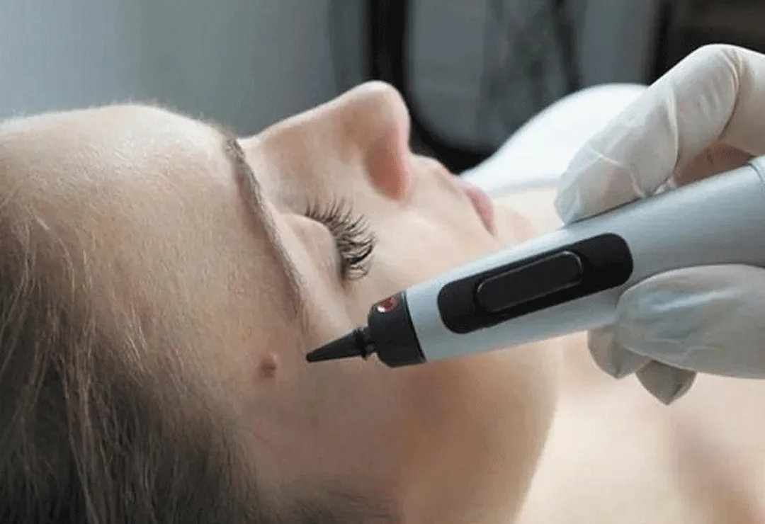 FAQs: Here's Everything You Need to Know About At-Home Cryotherapy Derby